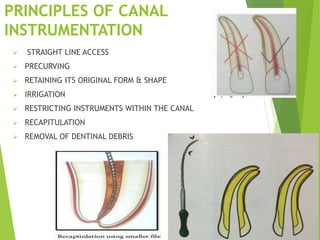 PRINCIPLES OF CANAL
INSTRUMENTATION
 STRAIGHT LINE ACCESS
 PRECURVING
 RETAINING ITS ORIGINAL FORM & SHAPE
 IRRIGATION
 RESTRICTING INSTRUMENTS WITHIN THE CANAL
 RECAPITULATION
 REMOVAL OF DENTINAL DEBRIS
 