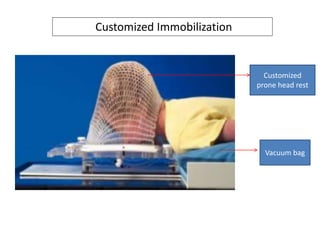 Customized Immobilization
Customized
prone head rest
Vacuum bag
 