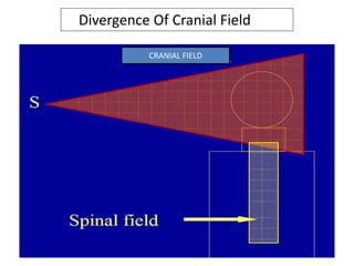 Divergence Of Cranial Field
CRANIAL FIELD
 