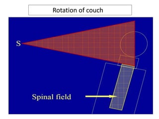 Rotation of couch
 