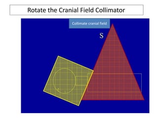 Rotate the Cranial Field Collimator
Collimate cranial field
 