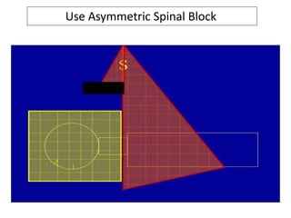 Use Asymmetric Spinal Block
 