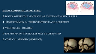 2) NON COMMUNICATING TYPE :
 BLOCK WITHIN THE VENTRICULAR SYSTEM AT VARIOUS SITES
 MOST COMMON IN THIRD VENTRICLE AND AQUEDUCT
 VENTRICLES – DILATED
 EPENDYMA OF VENTRICLES MAY BE DISRUPTED
 CORTICAL ATROPHY (MORE ICP)
 