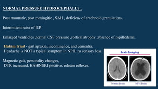 NORMAL PRESSURE HYDROCEPHALUS :
Post traumatic, post meningitic , SAH , deficieny of arachnoid granulations.
Intermittent raise of ICP
Enlarged ventricles ,normal CSF pressure ,cortical atrophy ,absence of papilledema.
Hakim triad - gait apraxia, incontinence, and dementia.
Headache is NOT a typical symptom in NPH, no sensory loss.
Magnetic gait, personality changes,
DTR increased, BABINSKI positive, release reflexes.
 