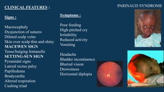 CLINICAL FEATURES :
Signs :
Macrocephaly
Dysjunction of sutures
Dilated scalp veins
Skin over scalp thin and shiny
MACEWEN SIGN
Tense/bulging fontanelle
SETTING-SUN SIGN
Pyramidal signs
Lateral rectus palsy
Papilledema
Bradycardia
Altered respiration
Cushing triad
Symptoms :
Poor feeding
High pitched cry
Irritability
Reduced activity
Vomiting
Headache
Bladder incontinence
Blurred vision
Drowsiness
Horizontal diplopia
PARINAUD SYNDROME
 