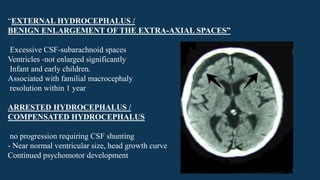 “EXTERNAL HYDROCEPHALUS /
BENIGN ENLARGEMENT OF THE EXTRA-AXIAL SPACES”
Excessive CSF-subarachnoid spaces
Ventricles -not enlarged significantly
Infant and early children.
Associated with familial macrocephaly
resolution within 1 year
ARRESTED HYDROCEPHALUS /
COMPENSATED HYDROCEPHALUS
no progression requiring CSF shunting
- Near normal ventricular size, head growth curve
Continued psychomotor development
 