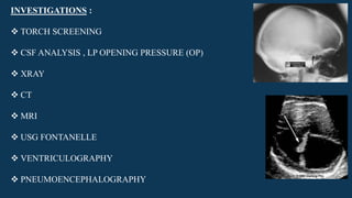 INVESTIGATIONS :
 TORCH SCREENING
 CSF ANALYSIS , LP OPENING PRESSURE (OP)
 XRAY
 CT
 MRI
 USG FONTANELLE
 VENTRICULOGRAPHY
 PNEUMOENCEPHALOGRAPHY
 