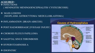 ACQUIRED :
 INFECTIONS
{ MENINGITIS/ MENINGOENCEPHALITIS/ CYSTICERCOSIS}
 MASS LESIONS
{NEOPLASM- ASTROCYTOMA/ MEDULLOBLASTOMA}
 INFLAMMATION {BRAIN ABSCESS}
 POST HAEMORRHAGIC{IVH/SAH/ INJURY}
 CHOROID PLEXUS PAPILLOMA
 SAGITTAL SINUS THROMBOSIS
 HYPERVITAMINOSIS A
 IDIOPATHIC
 