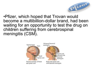 Pfizer, which hoped that Trovan would become a multibillion-dollar brand, had been waiting for an opportunity to test the drug on children suffering from cerebrospinal meningitis (CSM). 