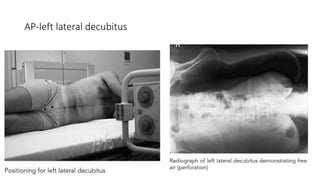 SMALL INTESTINE | PPTX