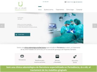 Som una clínica odontològica de Barcelona especialitzada en Periodòncia, és a dir, el
tractament de les malalties gingivals
 
