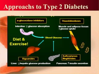 Approachs to Type 2 Diabetes
 