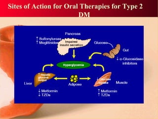Sites of Action for Oral Therapies for Type 2
DM
 