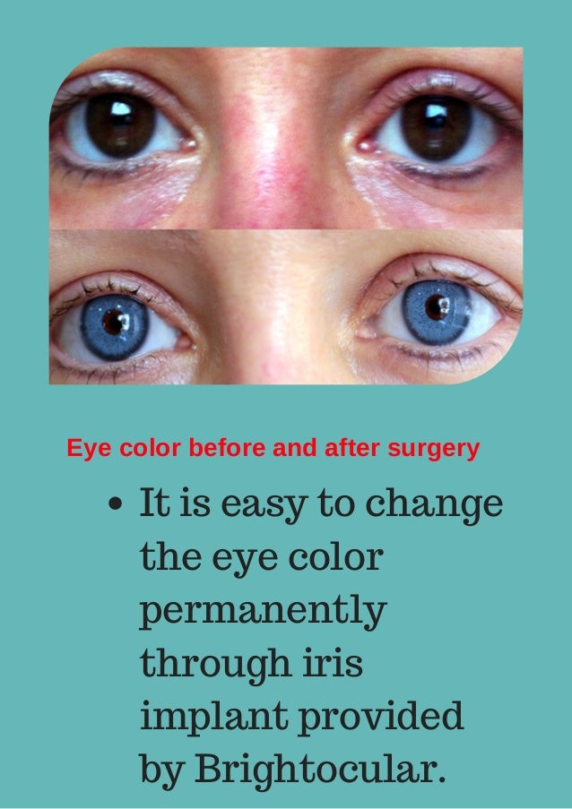 permanent colored contacts