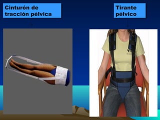 Cinturón de
tracción pélvica
Cinturón de
tracción pélvica
Tirante
pélvico
Tirante
pélvico
 