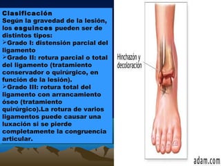 Clasificación
Según la gravedad de la lesión,
los esguinces pueden ser de
distintos tipos:
Grado I: distensión parcial del
ligamento
Grado II: rotura parcial o total
del ligamento (tratamiento
conservador o quirúrgico, en
función de la lesión).
Grado III: rotura total del
ligamento con arrancamiento
óseo (tratamiento
quirúrgico).La rotura de varios
ligamentos puede causar una
luxación si se pierde
completamente la congruencia
articular.
Clasificación
Según la gravedad de la lesión,
los esguinces pueden ser de
distintos tipos:
Grado I: distensión parcial del
ligamento
Grado II: rotura parcial o total
del ligamento (tratamiento
conservador o quirúrgico, en
función de la lesión).
Grado III: rotura total del
ligamento con arrancamiento
óseo (tratamiento
quirúrgico).La rotura de varios
ligamentos puede causar una
luxación si se pierde
completamente la congruencia
articular.
 