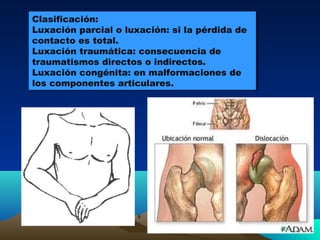 Clasificación:
Luxación parcial o luxación: si la pérdida de
contacto es total.
Luxación traumática: consecuencia de
traumatismos directos o indirectos.
Luxación congénita: en malformaciones de
los componentes articulares.
Clasificación:
Luxación parcial o luxación: si la pérdida de
contacto es total.
Luxación traumática: consecuencia de
traumatismos directos o indirectos.
Luxación congénita: en malformaciones de
los componentes articulares.
 