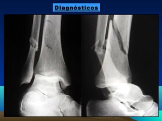 DiagnósticosDiagnósticos
 