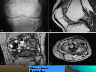 •Resonancia•Resonancia
Magnética
 