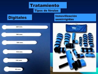 Tipos de férulasTipos de férulas
TratamientoTratamiento
DigitalesDigitales Inmovilización
semirrígidas
Inmovilización
semirrígidas
 