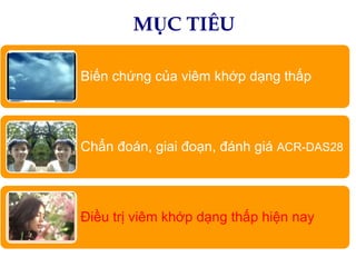 MỤC TIÊU
Biến chứng của viêm khớp dạng thấp

Chẩn đoán, giai đoạn, đánh giá ACR-DAS28

Điều trị viêm khớp dạng thấp hiện nay

 