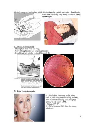 Bắt buộc trong mọi trường hợp VPM, túi cùng Douglas có dịch, mủ, máu,…ấn chẩn vào
                                  thành trước trực tràng căng phồng và rất đau “tiếng
                                  kêu Douglas”.




3.2.6 Chọc dò xoang bụng:
- Phương tiện chẩn đoán sau cùng.
- Vị trí: hông phải(trái) hay hố chậu phải(trái).
- Dịch hút gửi xét nghiệm và làm kháng sinh đồ.




3.3 Triệu chừng toàn thân:

                                           3.3.1 Biểu hiên tình trạng nhiễm trùng:
                                           - Lo âu, mắt trũng và thâm quầng, môi khô,
                                           lưỡi dơ, thở nhanh nông, cánh mũi phập
                                           phồng(vẽ mặt người VPM).
                                           - Sốt cao(390-400)
                                           3.3.2 Giai đoạn trễ, biểu hiện tình trạng
                                           nhiễm độc:



                                                                                        9
 