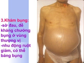 3.Khám bụng: -sờ đau, đề kháng chướng bụng ở vùng thượng vị -nhu động ruột giảm, có thể báng bụng 