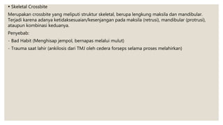  Skeletal Crossbite
Merupakan crossbite yang meliputi struktur skeletal, berupa lengkung maksila dan mandibular.
Terjadi karena adanya ketidaksesuaian/kesenjangan pada maksila (retrusi), mandibular (protrusi),
ataupun kombinasi keduanya.
Penyebab:
- Bad Habit (Menghisap jempol, bernapas melalui mulut)
- Trauma saat lahir (ankilosis dari TMJ oleh cedera forseps selama proses melahirkan)
 