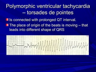 Polymorphic ventricular tachycardiaPolymorphic ventricular tachycardia
– torsades de pointes– torsades de pointes
Is connected with prolonged QT interval.Is connected with prolonged QT interval.
The place of origin of the beats is moving – thatThe place of origin of the beats is moving – that
leads into different shape of QRSleads into different shape of QRS
 