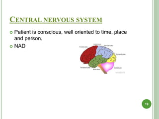 CENTRAL NERVOUS SYSTEM
 Patient is conscious, well oriented to time, place
and person.
 NAD
19
 
