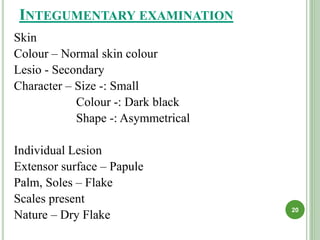 INTEGUMENTARY EXAMINATION
Skin
Colour – Normal skin colour
Lesio - Secondary
Character – Size -: Small
Colour -: Dark black
Shape -: Asymmetrical
Individual Lesion
Extensor surface – Papule
Palm, Soles – Flake
Scales present
Nature – Dry Flake
20
 