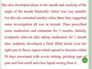 She also developed ulcers in the mouth and cracking of the
angle of the mouth bilaterally which was very painful.
For this she consulted another clinic there they suggested
some investigation all was in normal. Than prescribed
some medication and ointments for 3 months. Initially
symptoms relieved after taking medication for 1 month
later suddenly developed a fluid filled lesion over her
right arm in flexor aspect which spread to forearm within
20 days associated with severe itching, pricking type of
pain and foul smell and clear liquid oozing from it.
49
 