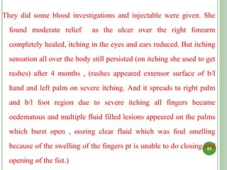 They did some blood investigations and injectable were given. She
found moderate relief as the ulcer over the right forearm
completely healed, itching in the eyes and ears reduced. But itching
sensation all over the body still persisted (on itching she used to get
rashes) after 4 months , (rashes appeared extensor surface of b/l
hand and left palm on severe itching. And it spreads to right palm
and b/l foot region due to severe itching all fingers became
oedematous and multiple fluid filled lesions appeared on the palms
which burst open , oozing clear fluid which was foul smelling
because of the swelling of the fingers pt is unable to do closing and
opening of the fist.)
51
 