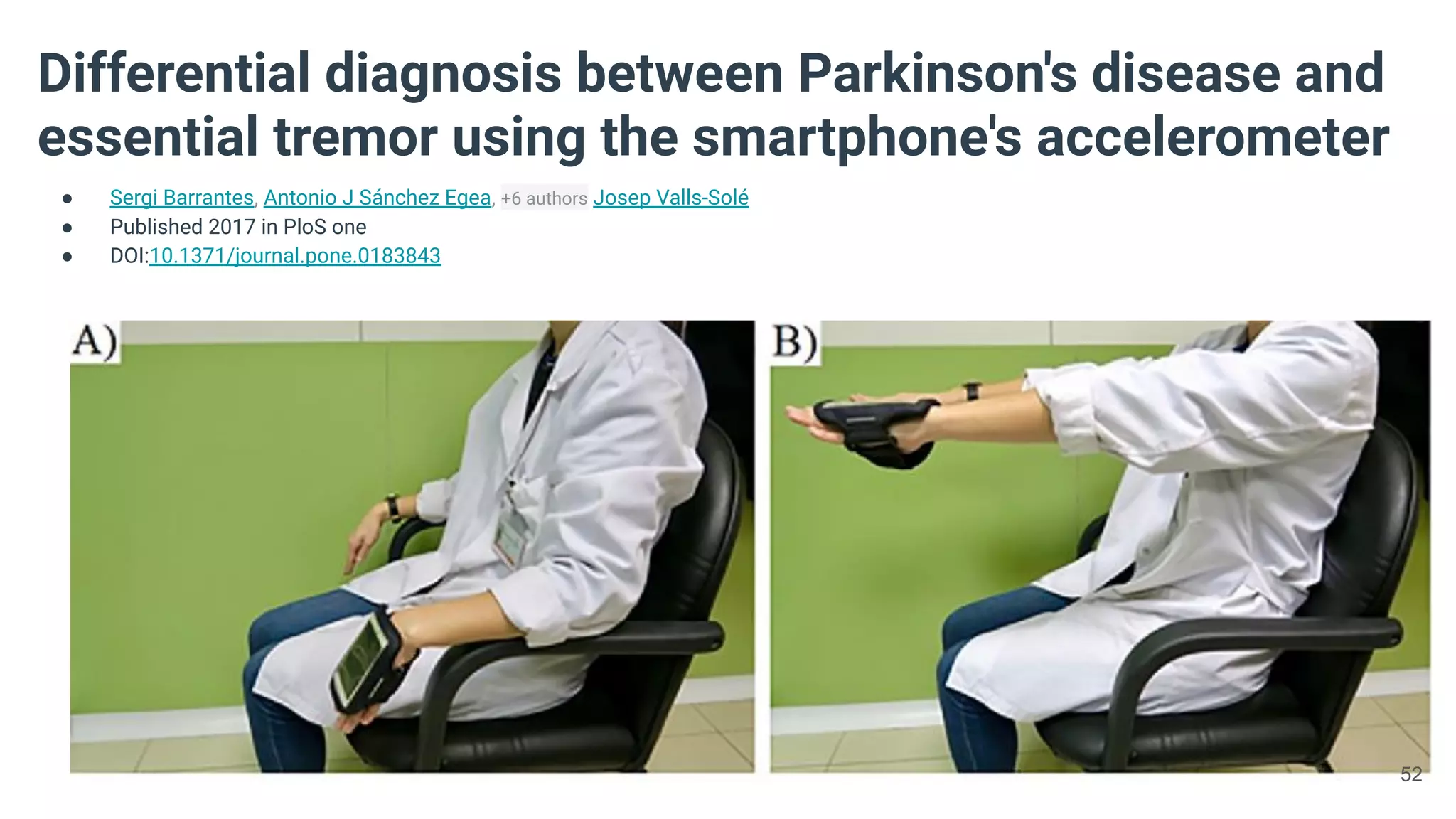 Differential diagnosis between Parkinson's disease and
essential tremor using the smartphone's accelerometer
● Sergi Barrantes, Antonio J Sánchez Egea, +6 authors Josep Valls-Solé
● Published 2017 in PloS one
● DOI:10.1371/journal.pone.0183843
52
 