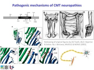 Pathogenic mechanisms of CMT neuropathies
Redrawing of original figures by (A) Tooth, (B,C) Dejerine
& Sottas. By J. Berciano, MUSCLE & NERVE (2003)
 