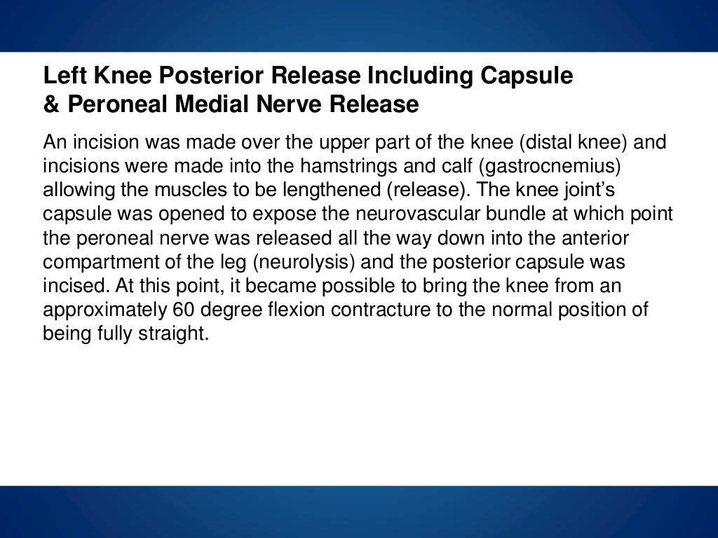 Pseudopterygium image