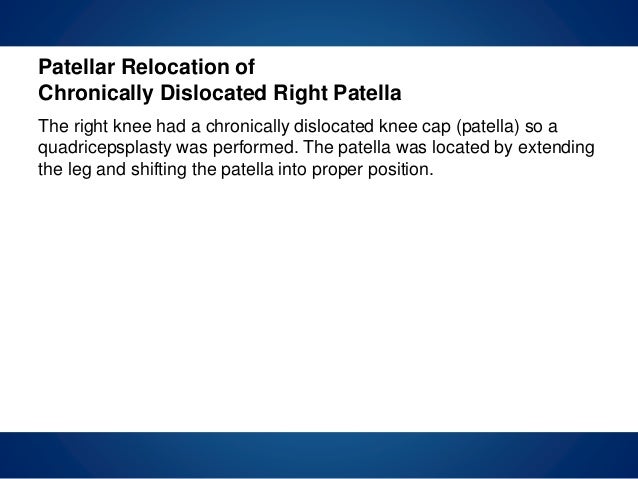 Pterygium case study picture