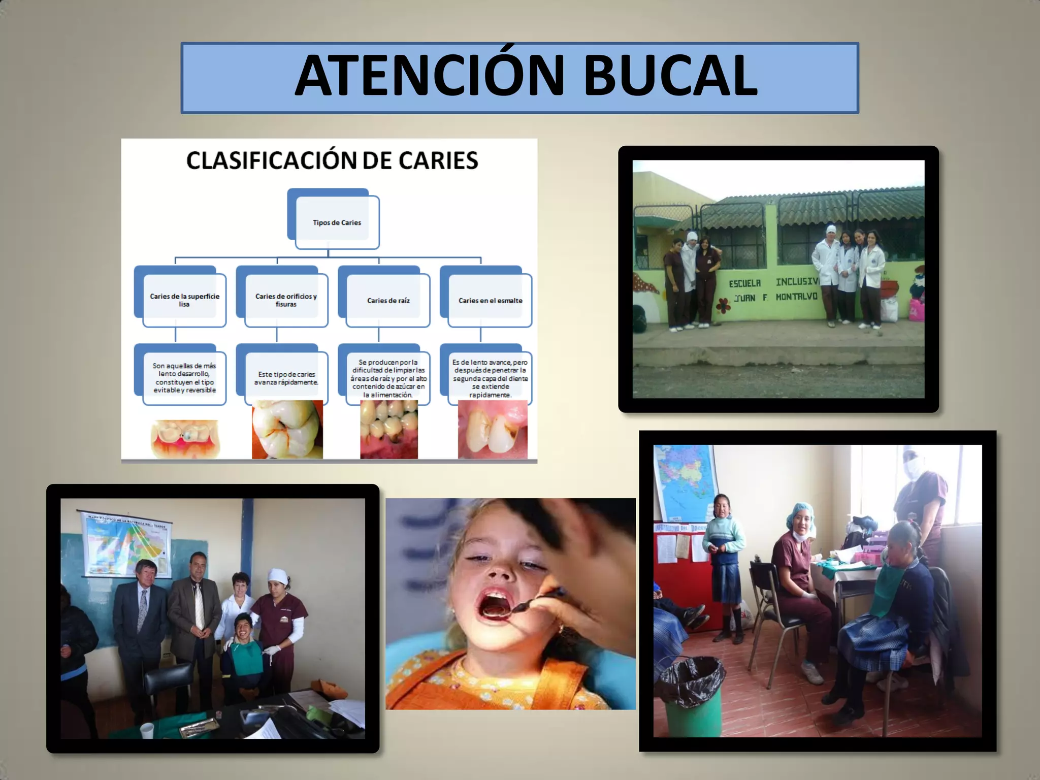 ATENCIÓN BUCAL

 