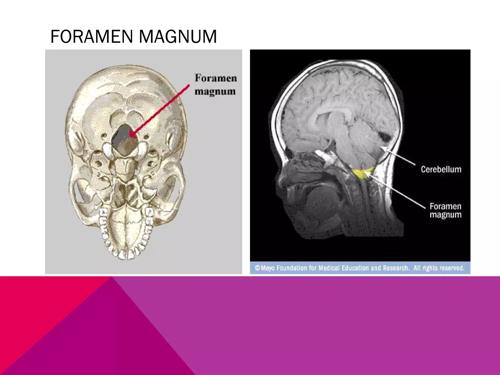 FORAMEN MAGNUM 
 