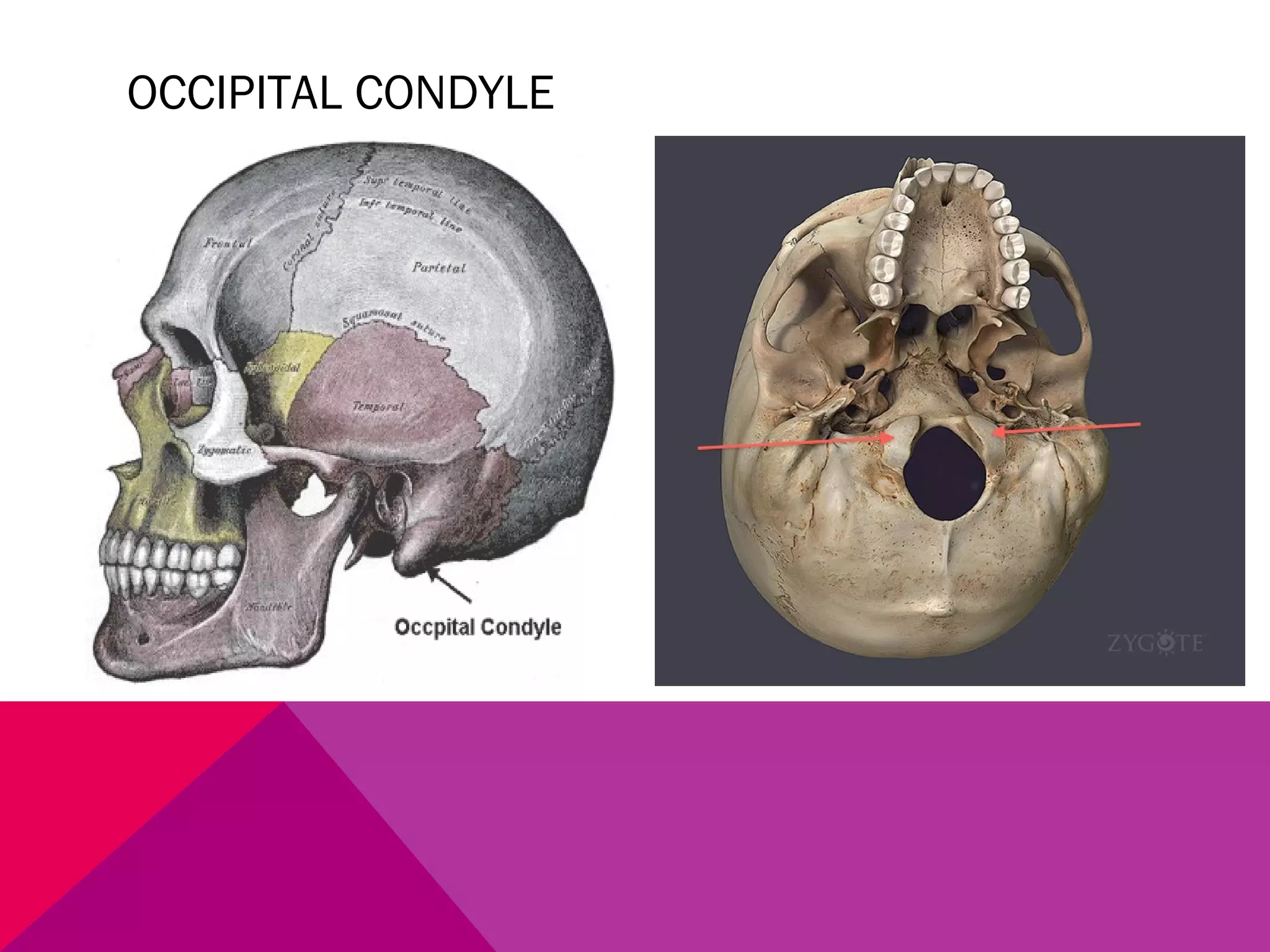 OCCIPITAL CONDYLE 
 