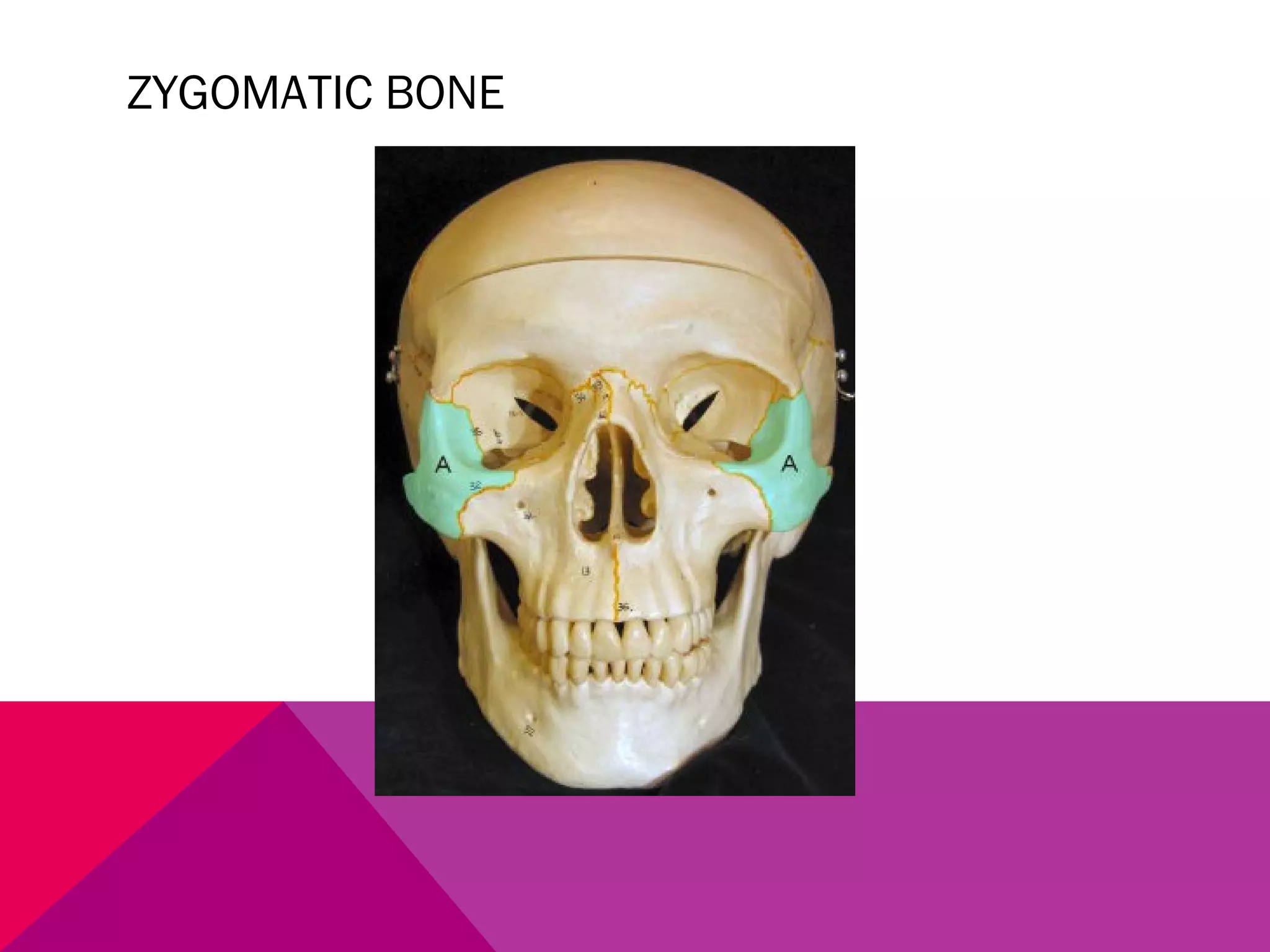 ZYGOMATIC BONE 
 