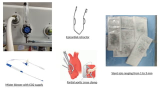 Mister blower with CO2 supply
Epicardial retractor
Partial aortic cross clamp
Stent size ranging from 1 to 3 mm
 