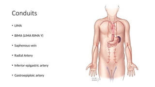 Conduits
• LIMA
• BIMA (LIMA RIMA Y)
• Saphenous vein
• Radial Artery
• Inferior epigastric artery
• Gastroepiploic artery
 