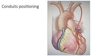 Conduits positioning
 