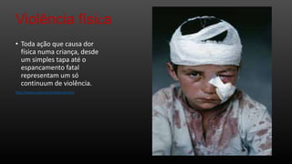 Violência física
• Toda ação que causa dor
física numa criança, desde
um simples tapa até o
espancamento fatal
representam um só
continuum de violência.
http://www.cuida.org.br/violencia.html

 