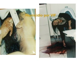 Homicidio por VIF
 