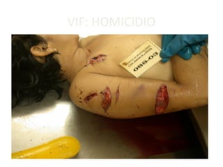 VIF: HOMICIDIO
 