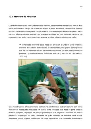 103
10.5. Manobra de Kristeller
Quando foi desenvolvida sem fundamentação científica, essa manobra era realizada com as duas
mãos empurrando a barriga da mulher em direção à pelve. Atualmente, dispomos de diversos
estudos que demonstram as graves complicações da prática desse procedimento e apesar disso a
manobra é frequentemente realizada com uma pessoa subindo em cima da barriga da mulher, ou
expremendo seu ventre com o peso do corpo sobre as mãos, o braço, antebraço ou joelho.
“A compressão abdominal pelas mãos que envolvem o fundo do útero constitui a
manobra de Kristeller. Este recurso foi abandonado pelas graves conseqüências
que lhe são inerentes (trauma das víceras abdominais, do útero, descolamento da
placenta).” (Obstetrícia Normal, manual de BRIQUET) (DELASCIO; GUARIENTO,
1970:329)
Essa manobra ainda é frequentemente realizada na assistência ao parto em conjunto com outras
intervenções inadequadas realizadas em cadeia, como condução para mesa de parto antes da
dilatação completa, imposição de posição ginecológica (que prejudica a dinâmica do parto e
prejudica a oxigenação do bebê), comandos de puxo, mudança de ambiente, entre outros.
Salienta-se que os próprios profissionais de saúde reconhecem que a manobra de kristeller é
 