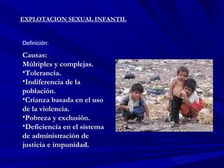 EXPLOTACION SEXUAL INFANTIL Definición: Causas: Múltiples y complejas. Tolerancia. Indiferencia de la población. Crianza basada en el uso de la violencia. Pobreza y exclusión. Deficiencia en el sistema de administración de justicia e impunidad. 