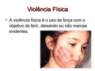 Violência Física A violência física é o uso da força com o objetivo de ferir, deixando ou não marcas evidentes. 